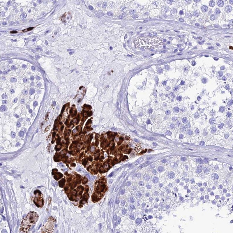 Atlas Antibodies Anti-OR4D5 Antibody