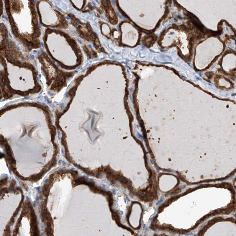 Atlas Antibodies Anti-OR4K1 Antibody