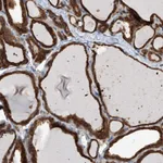 Atlas Antibodies Anti-OR4K1 Antibody