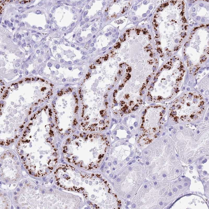 Atlas Antibodies Anti-OR4F3 Antibody