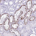 Atlas Antibodies Anti-OR4F3 Antibody