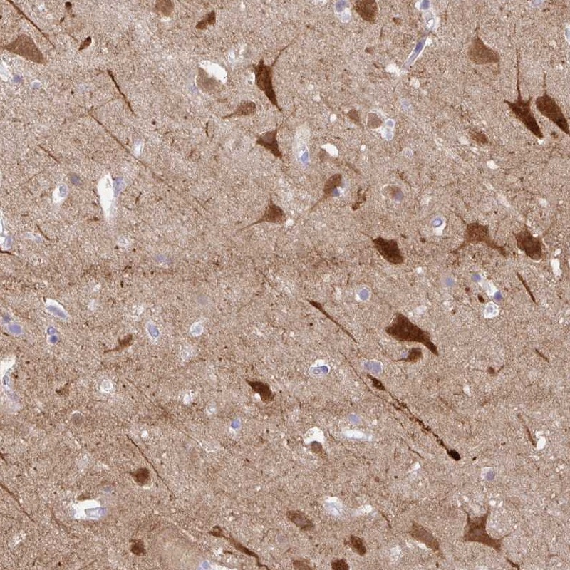 Atlas Antibodies Anti-OR4N4 Antibody