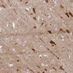 Atlas Antibodies Anti-OR4N4 Antibody
