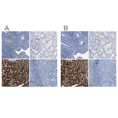 Merck Anti-ASGR1 antibody produced in rabbit