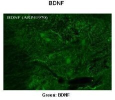 Merck ANTI-BDNF