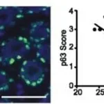Thermo Fisher Scientific Goat anti-Rabbit IgG (H+L) Cross-Adsorbed Secondary Antibody, Alexa Fluor 546