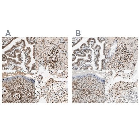 Merck ANTI-SUN1 antibody produced in rabbit
