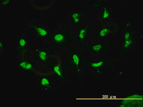 Merck Monoclonal Anti-HDAC11 antibody produced in mouse