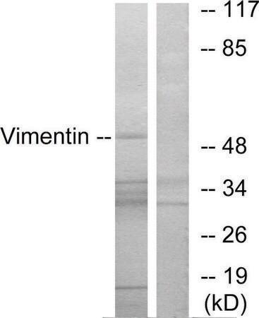 Merck Anti-Vimentin antibody produced in rabbit