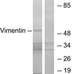 Merck Anti-Vimentin antibody produced in rabbit
