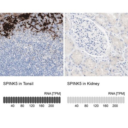 Merck Anti-SPINK5 antibody produced in rabbit