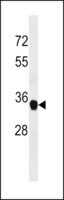Merck ANTI-FAM164A(C-TERMINAL)