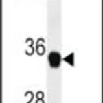 Merck ANTI-FAM164A(C-TERMINAL)