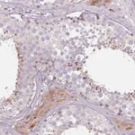 Merck Anti-SPAG4 antibody produced in rabbit