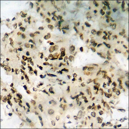 Merck Anti-phospho-RAD51 (pTyr315) antibody produced in rabbit