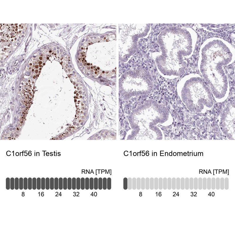 Atlas Antibodies Anti-C1orf56 Antibody
