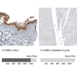 Atlas Antibodies Anti-C1orf68 Antibody