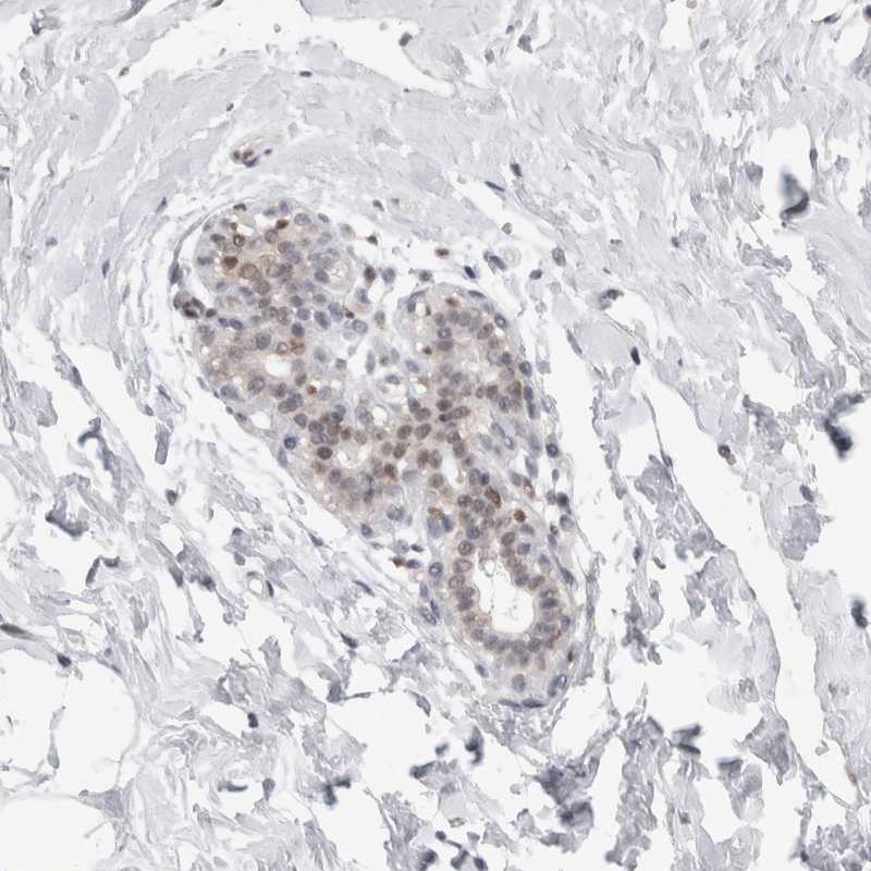 Atlas Antibodies Anti-C1orf64 Antibody
