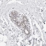 Atlas Antibodies Anti-C1orf64 Antibody