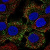 Atlas Antibodies Anti-C1orf68 Antibody