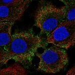 Atlas Antibodies Anti-C1orf68 Antibody