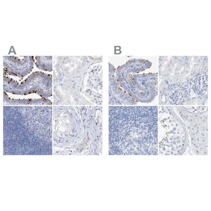Atlas Antibodies Anti-C1orf87 Antibody