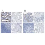 Atlas Antibodies Anti-C1orf87 Antibody