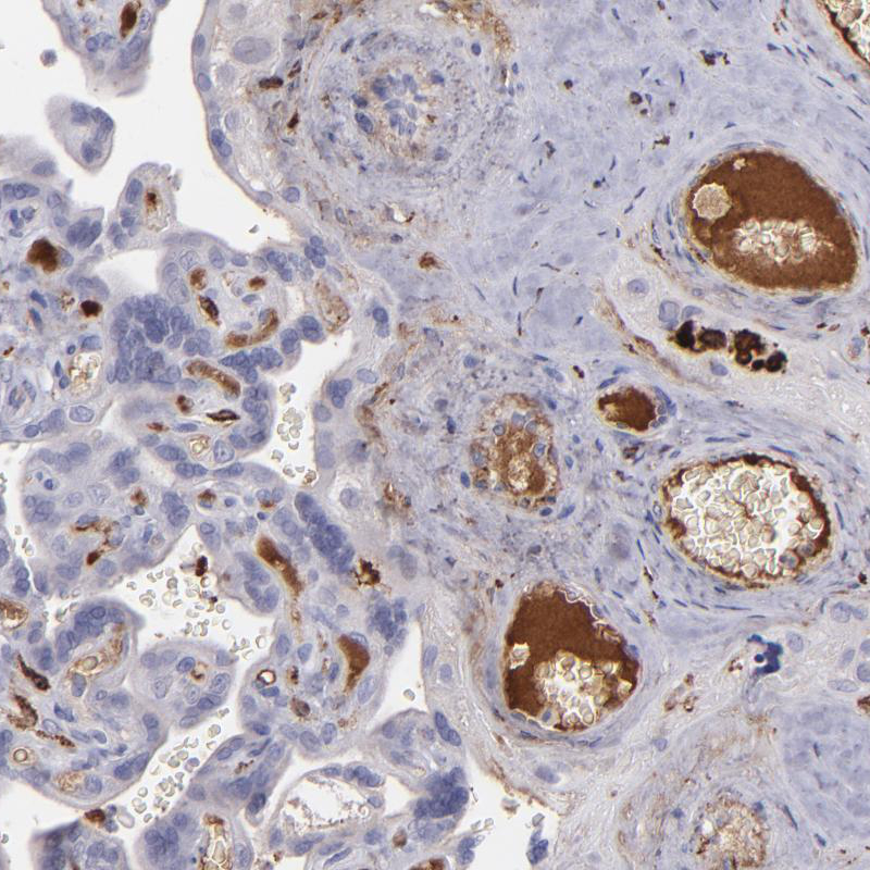 Atlas Antibodies Anti-C1QA Antibody