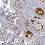 Atlas Antibodies Anti-C1QA Antibody