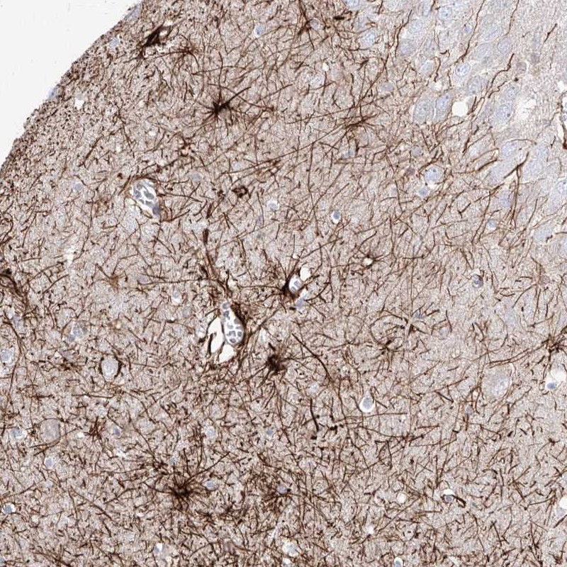 Atlas Antibodies Anti-C1orf74 Antibody