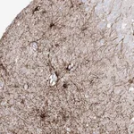 Atlas Antibodies Anti-C1orf74 Antibody