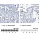 Atlas Antibodies Anti-C1orf87 Antibody
