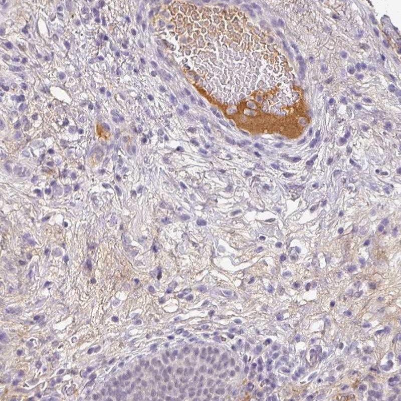 Atlas Antibodies Anti-C1QB Antibody