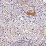 Atlas Antibodies Anti-C1QB Antibody