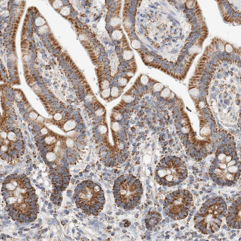 Atlas Antibodies Anti-C1QBP Antibody