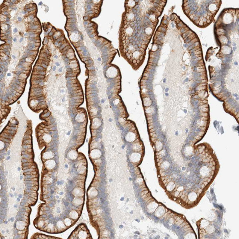 Atlas Antibodies Anti-C1QTNF12 Antibody