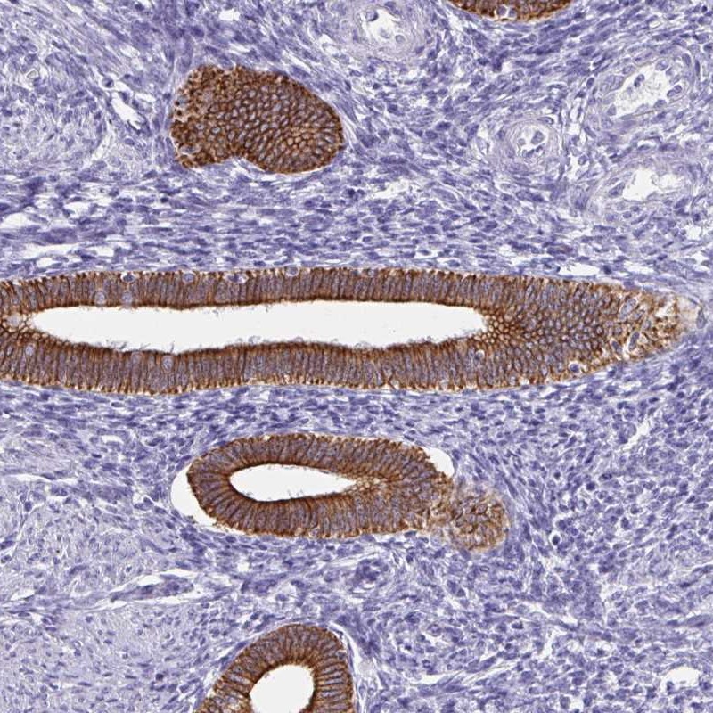 Atlas Antibodies Anti-C1QTNF2 Antibody