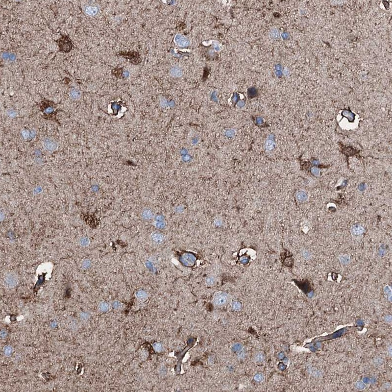 Atlas Antibodies Anti-C1QTNF4 Antibody