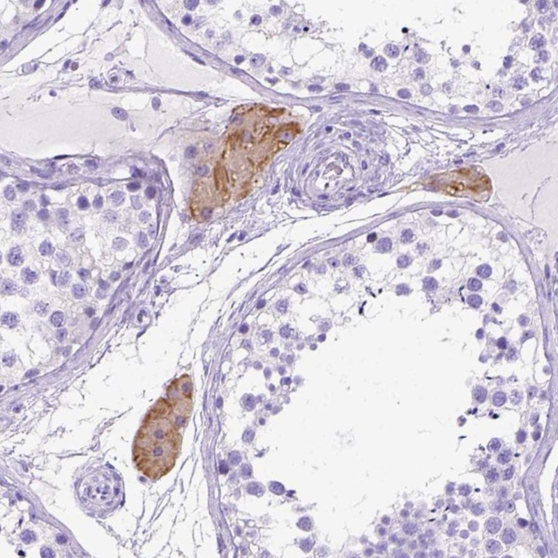 Atlas Antibodies Anti-C1QTNF3 Antibody