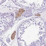 Atlas Antibodies Anti-C1QTNF3 Antibody