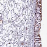 Atlas Antibodies Anti-C1QTNF5 Antibody