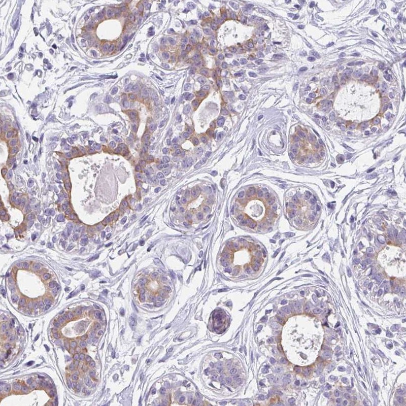 Atlas Antibodies Anti-C1QTNF8 Antibody