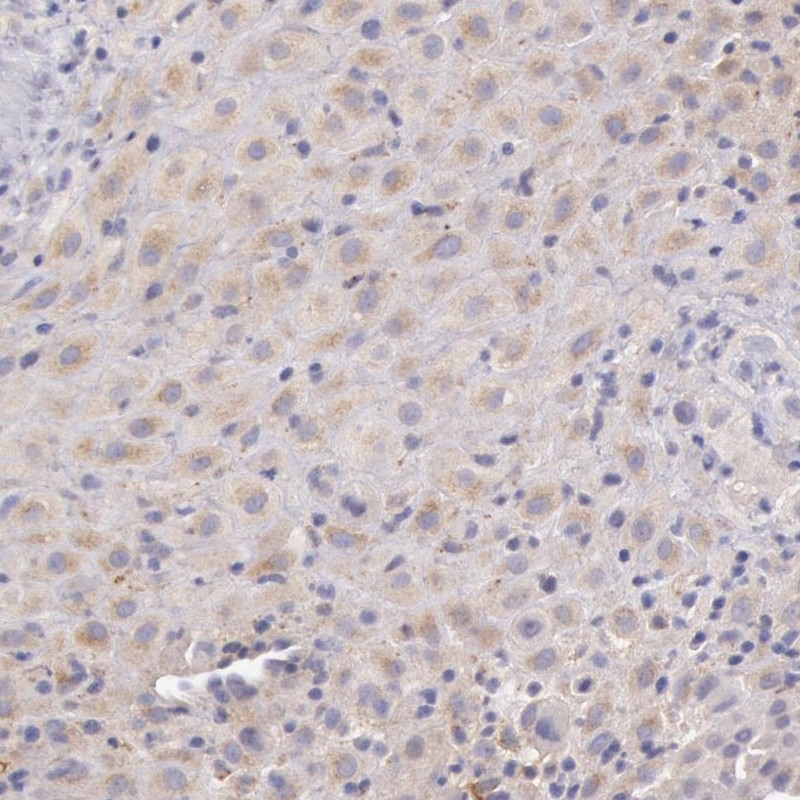 Atlas Antibodies Anti-C1R Antibody