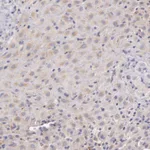 Atlas Antibodies Anti-C1R Antibody