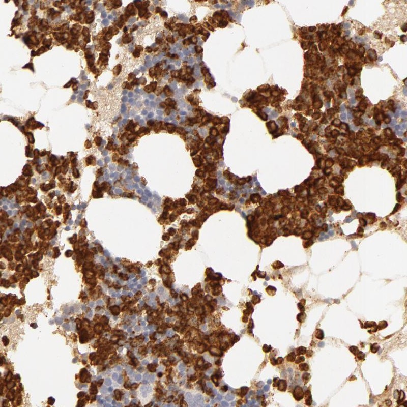 Atlas Antibodies Anti-C1R Antibody