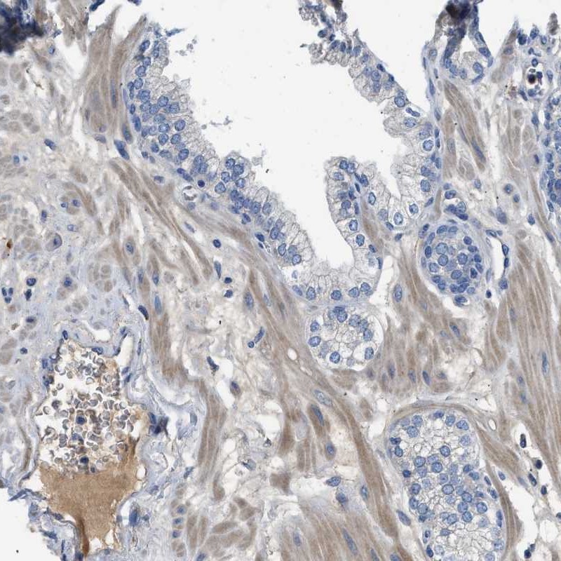 Atlas Antibodies Anti-C1S Antibody