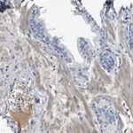 Atlas Antibodies Anti-C1S Antibody