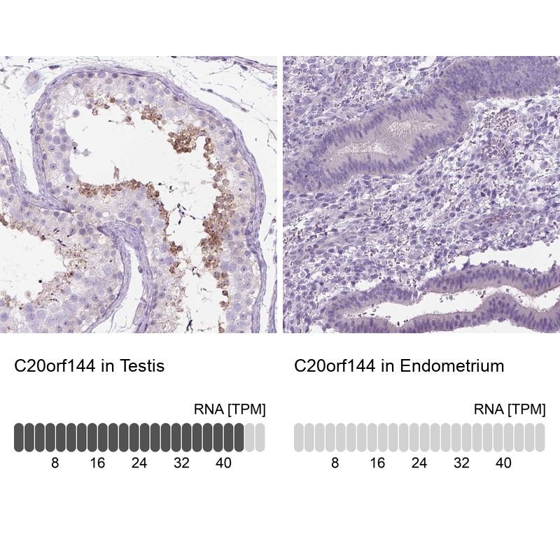 Atlas Antibodies Anti-C20orf144 Antibody