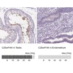 Atlas Antibodies Anti-C20orf144 Antibody