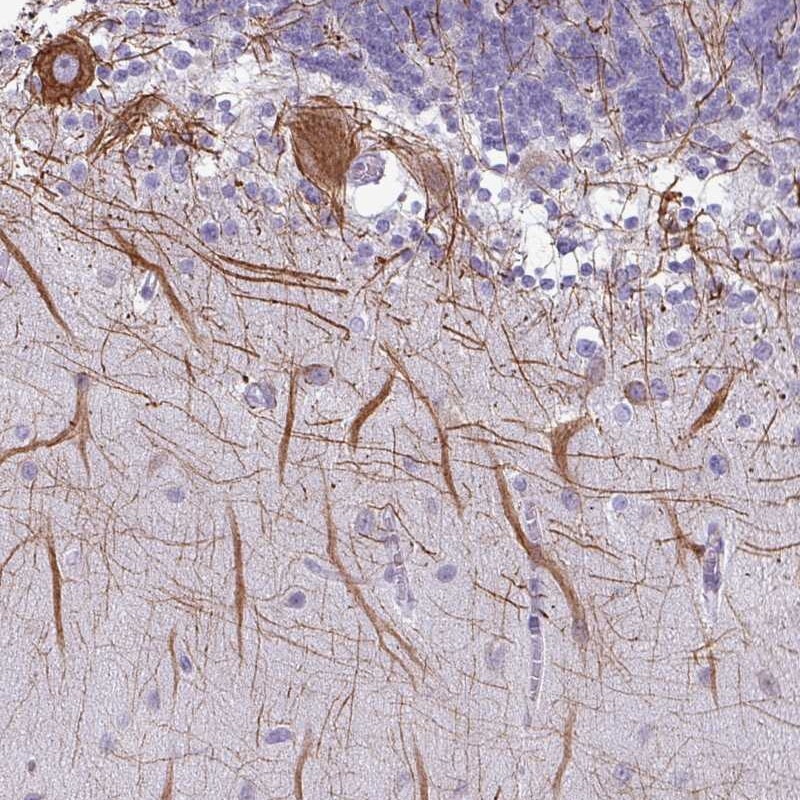 Atlas Antibodies Anti-C20orf194 Antibody